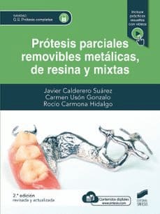 PROTESIS PARCIALES REMOVIBLES METALICAS DE RESINA Y MIXTAS. 2.ª edición revisada y actualizada
