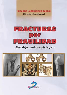 FRACTURAS POR FRAGILIDAD. Abordaje médico quirúrgico