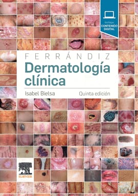FERRÁNDIZ DERMATOLOGÍA CLÍNICA