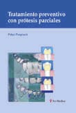 TRATAMIENTO PREVENTIVO CON PROTESIS PARCIALES