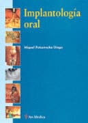 IMPLANTOLOGÍA ORAL