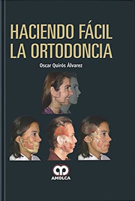 HACIENDO FACIL LA ORTODONCIA