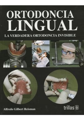 ORTODONCIA LINGUAL LA VERDADERA ORTODONCIA INVISIBLE